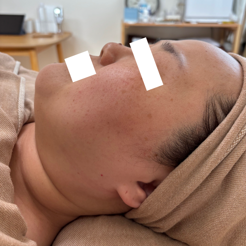 検討材料としてビフォーアフターを掲載